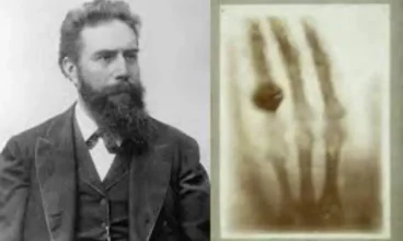 Le curiosità di Diagnostika: Chi ha inventato i Raggi x?
